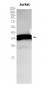 PPP2CA/B (7Z19) Rabbit Monoclonal Antibody