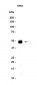 TGF beta 1/3 (12N11) Rabbit Monoclonal Antibody