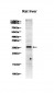 TNF alpha (8B2) Rabbit Monoclonal Antibody