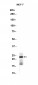 TPD52 (14S6) Rabbit Monoclonal Antibody
