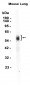 uPA Receptor/U-PAR (1F11) Rabbit Monoclonal Antibody