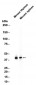 CD38 (14S19) Rabbit Monoclonal Antibody