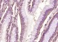 Patched Rabbit pAb