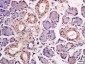 HPV16 E7 Rabbit pAb