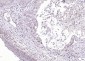 HPV16 E7 Rabbit pAb