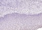 HPV16 E7 Rabbit pAb