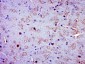 phospho-Calmodulin 1/2/3 (Ser102) Rabbit pAb