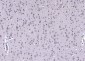 AEBP1 Rabbit pAb