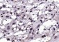 AEBP1 Rabbit pAb