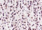 Di-Methyl-Histone H3 (Lys27) Recombinant Mouse mAb