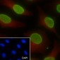 Di-Methyl-Histone H3 (Lys27) Recombinant Mouse mAb