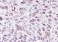 Di-Methyl-Histone H3 (Lys56) Recombinant Rabbit mAb