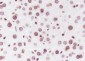 Di-Methyl-Histone H3 (Lys56) Recombinant Rabbit mAb
