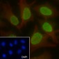 Di-Methyl-Histone H3 (Lys56) Recombinant Rabbit mAb