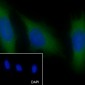 PLCB3 Recombinant Mouse mAb