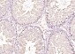 Retinoic acid induced 17 Rabbit pAb