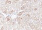 FASN Recombinant Rabbit mAb