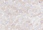 FASN Recombinant Rabbit mAb