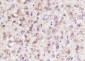 FASN Recombinant Rabbit mAb