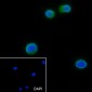 TFEB Recombinant Rabbit mAb
