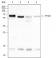 TFEB Recombinant Rabbit mAb