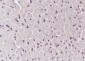 FLII Recombinant Mouse mAb