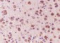 APOE Recombinant Mouse mAb