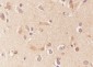 APOE Recombinant Mouse mAb
