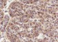 UBC12 Recombinant Mouse mAb