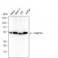 PABPN1 Recombinant Mouse mAb