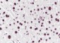 PABPN1 Recombinant Mouse mAb