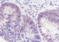 PABPN1 Recombinant Mouse mAb
