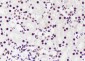 PABPN1 Recombinant Mouse mAb