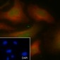 PABPN1 Recombinant Mouse mAb
