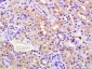 phospho-PPAR alpha (Ser12) Rabbit pAb