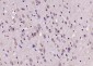Phospho-ALOX5 (Ser663) Rabbit pAb