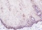 Keratin 15 Recombinant Rabbit mAb