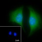 ELP3 Recombinant Rabbit mAb