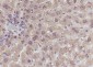 GCK Recombinant Mouse mAb