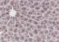 GCK Recombinant Mouse mAb