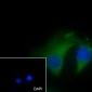 GCK Recombinant Mouse mAb