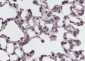 PTGER2 Recombinant Rabbit mAb