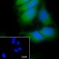 Keratin 14 Recombinant Rabbit mAb