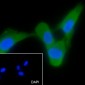 Keratin 14 Recombinant Rabbit mAb