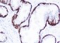 Keratin 14 Recombinant Rabbit mAb