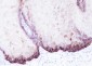 Keratin 14 Recombinant Rabbit mAb