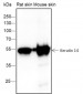 Keratin 14 Recombinant Rabbit mAb
