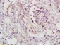 LIFR Rabbit pAb