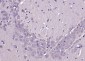 LIFR Rabbit pAb