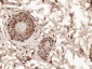 phospho-CK18 (Ser52) Rabbit pAb
